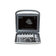 Prenosný ultrazvukový prístroj ECO1